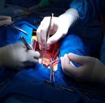 После операции на сердце - Кардиолог - сайт о заболеваниях сердца и сосудов