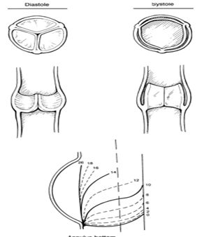 Позиция аортальных створок в конце диастолы и систолы
