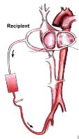 Схематическое изображение органов грудной клетки после удаления сердца реципиента (кардиоэктомии) в условиях искусственного кровообращения